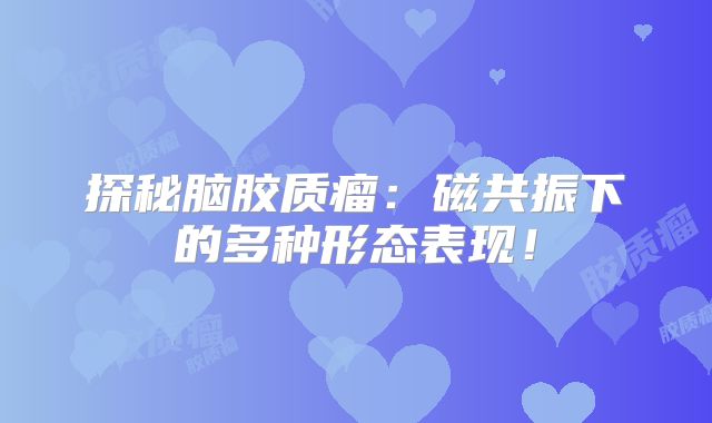 探秘脑胶质瘤：磁共振下的多种形态表现！