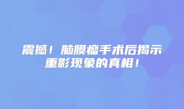 震撼！脑膜瘤手术后揭示重影现象的真相！