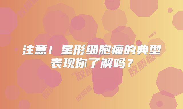 注意！星形细胞瘤的典型表现你了解吗？