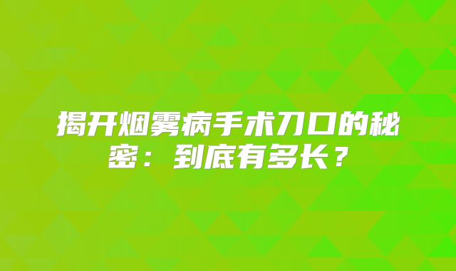 揭开烟雾病手术刀口的秘密：到底有多长？
