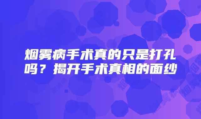 烟雾病手术真的只是打孔吗？揭开手术真相的面纱