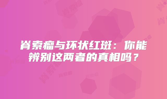 脊索瘤与环状红斑：你能辨别这两者的真相吗？