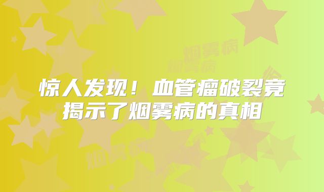 惊人发现！血管瘤破裂竟揭示了烟雾病的真相