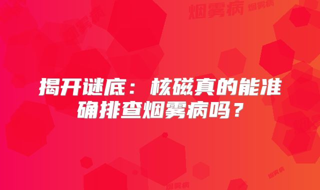 揭开谜底：核磁真的能准确排查烟雾病吗？