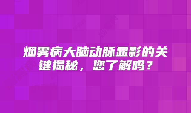 烟雾病大脑动脉显影的关键揭秘，您了解吗？