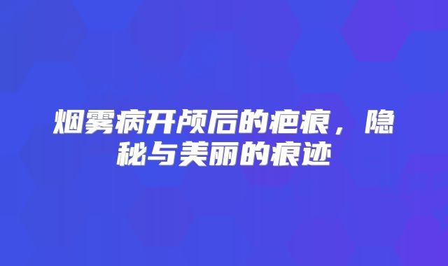 烟雾病开颅后的疤痕，隐秘与美丽的痕迹