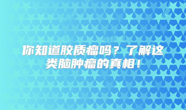 你知道胶质瘤吗？了解这类脑肿瘤的真相！