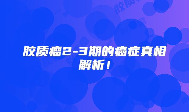 胶质瘤2-3期的癌症真相解析！
