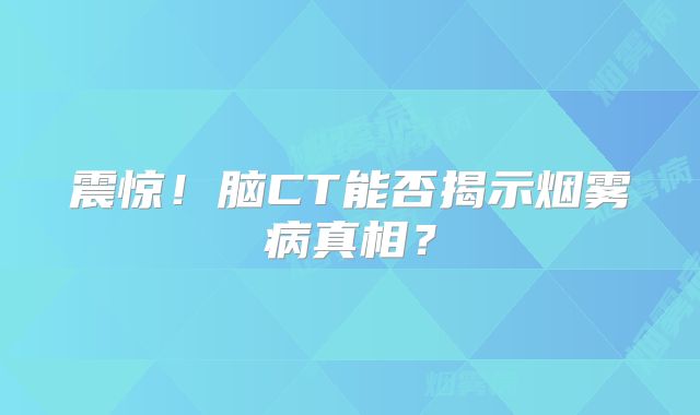 震惊！脑CT能否揭示烟雾病真相？