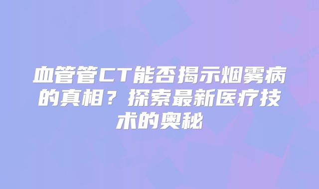 血管管CT能否揭示烟雾病的真相？探索最新医疗技术的奥秘