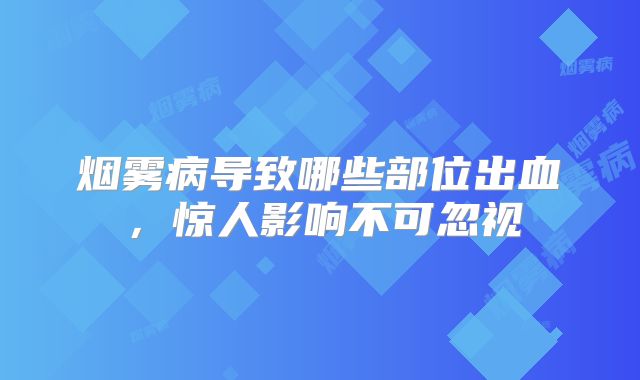 烟雾病导致哪些部位出血，惊人影响不可忽视