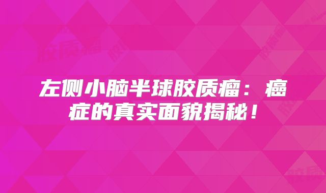 左侧小脑半球胶质瘤：癌症的真实面貌揭秘！