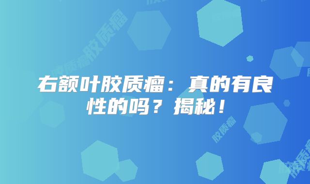 右额叶胶质瘤：真的有良性的吗？揭秘！