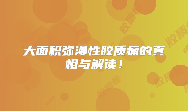 大面积弥漫性胶质瘤的真相与解读！