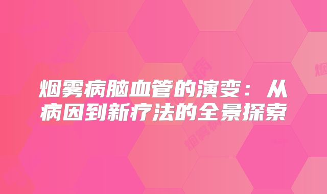 烟雾病脑血管的演变：从病因到新疗法的全景探索