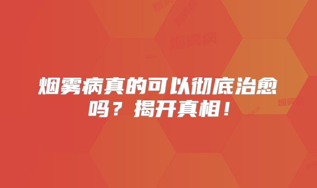 烟雾病真的可以彻底治愈吗？揭开真相！