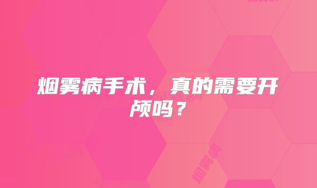 烟雾病手术，真的需要开颅吗？