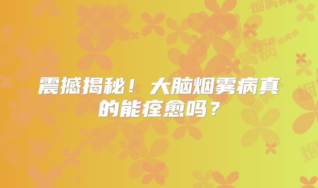 震撼揭秘！大脑烟雾病真的能痊愈吗？