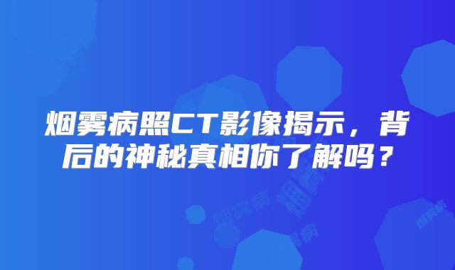 烟雾病照CT影像揭示，背后的神秘真相你了解吗？