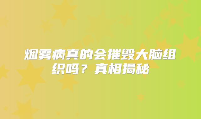 烟雾病真的会摧毁大脑组织吗？真相揭秘