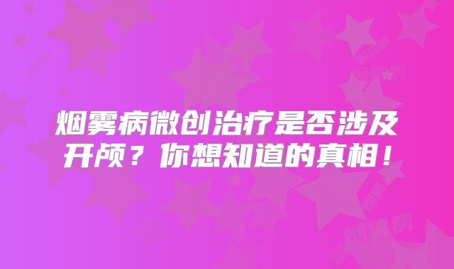 烟雾病微创治疗是否涉及开颅？你想知道的真相！