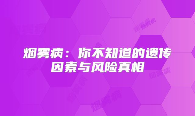 烟雾病：你不知道的遗传因素与风险真相