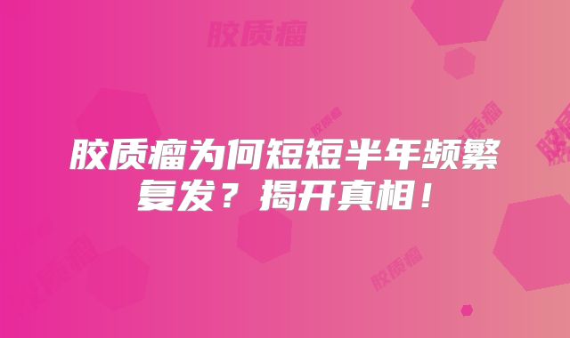 胶质瘤为何短短半年频繁复发？揭开真相！
