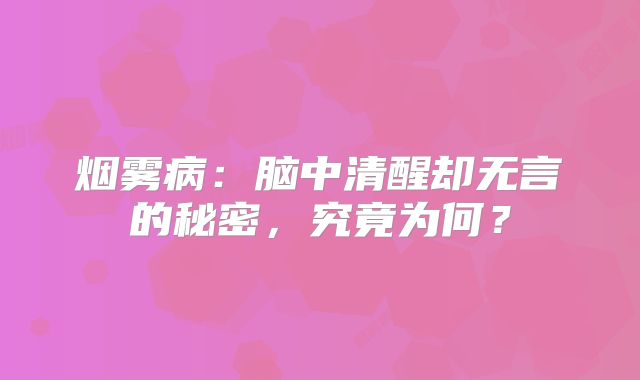 烟雾病：脑中清醒却无言的秘密，究竟为何？