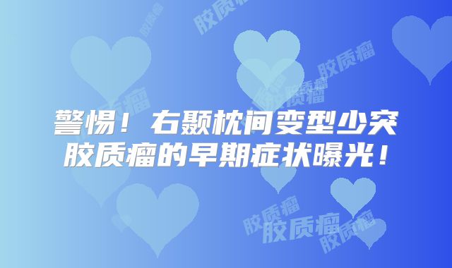 警惕！右颞枕间变型少突胶质瘤的早期症状曝光！