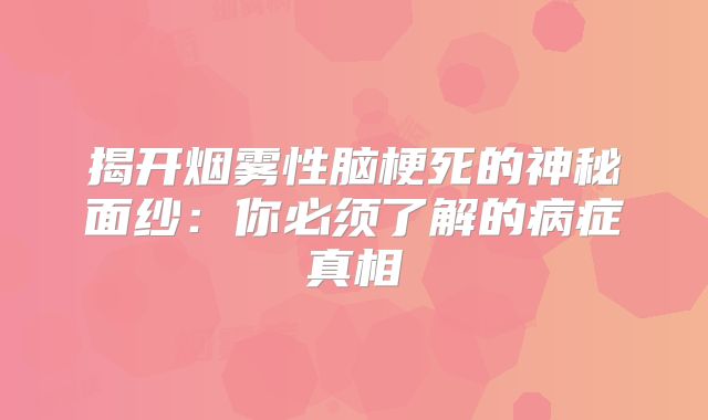 揭开烟雾性脑梗死的神秘面纱：你必须了解的病症真相