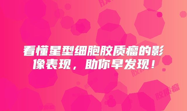 看懂星型细胞胶质瘤的影像表现，助你早发现！