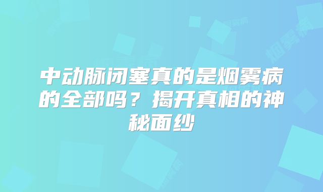 中动脉闭塞真的是烟雾病的全部吗？揭开真相的神秘面纱