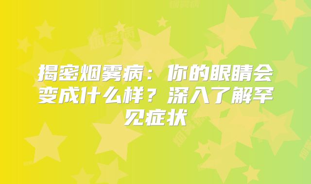 揭密烟雾病：你的眼睛会变成什么样？深入了解罕见症状