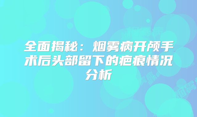 全面揭秘：烟雾病开颅手术后头部留下的疤痕情况分析