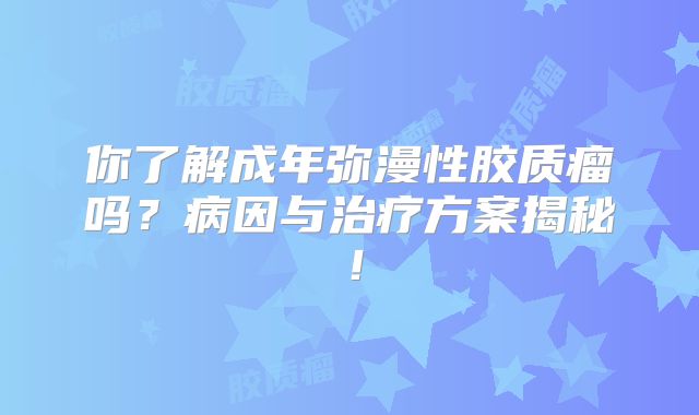 你了解成年弥漫性胶质瘤吗？病因与治疗方案揭秘！