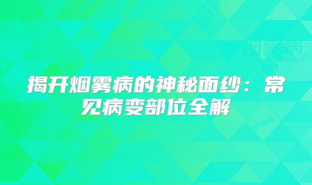 揭开烟雾病的神秘面纱：常见病变部位全解