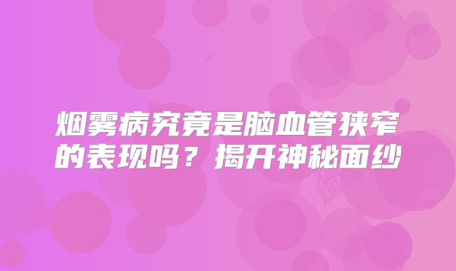 烟雾病究竟是脑血管狭窄的表现吗？揭开神秘面纱