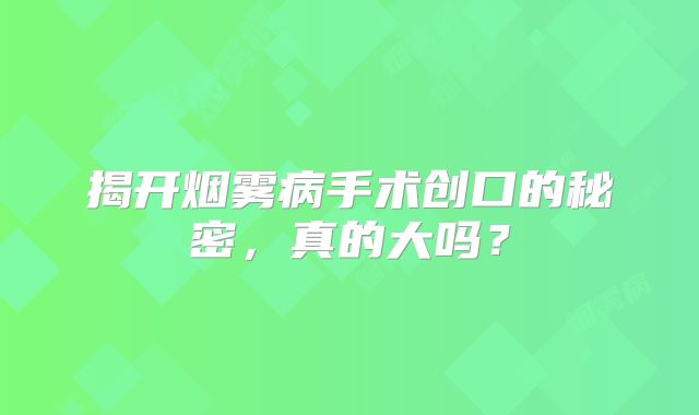 揭开烟雾病手术创口的秘密，真的大吗？