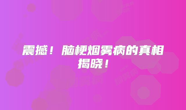 震撼！脑梗烟雾病的真相揭晓！