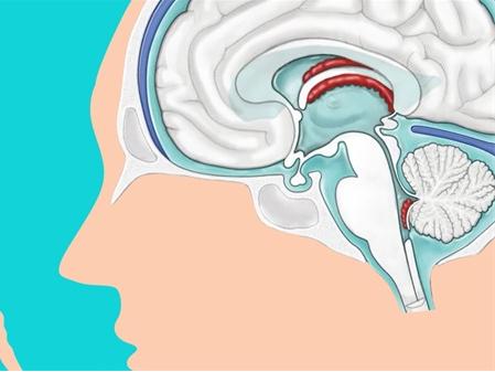 松果体区边缘尖锐肿瘤：你了解这些医学突破背后的秘密吗？