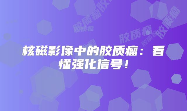 核磁影像中的胶质瘤：看懂强化信号！