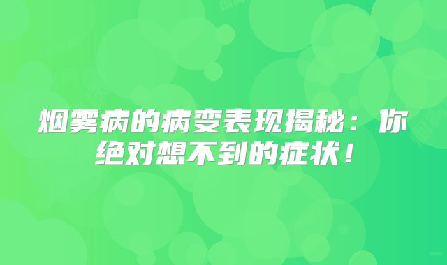 烟雾病的病变表现揭秘：你绝对想不到的症状！