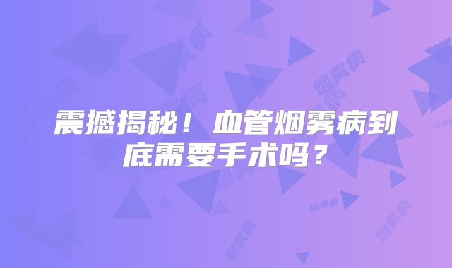 震撼揭秘！血管烟雾病到底需要手术吗？