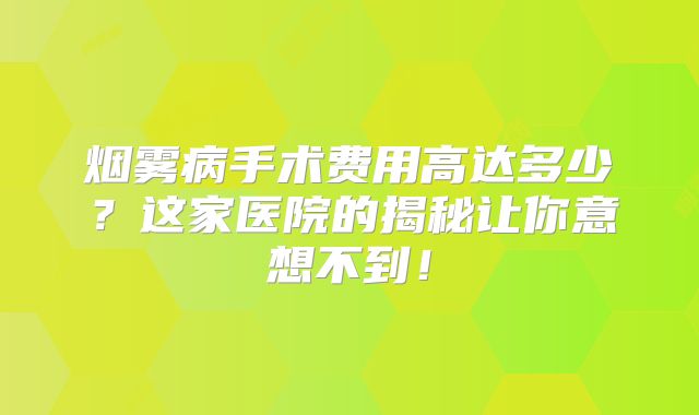 烟雾病手术费用高达多少？这家医院的揭秘让你意想不到！