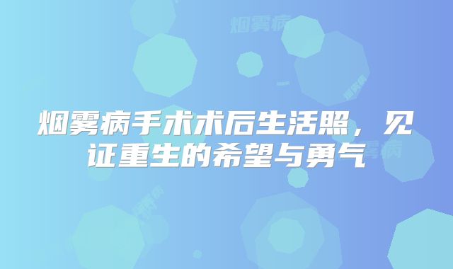 烟雾病手术术后生活照，见证重生的希望与勇气