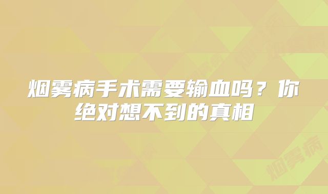 烟雾病手术需要输血吗？你绝对想不到的真相