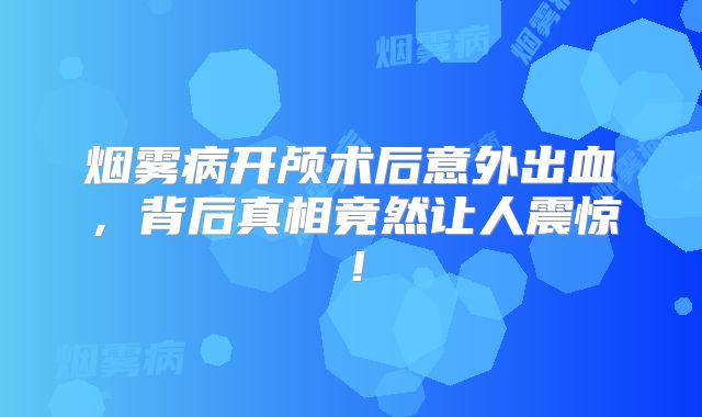 烟雾病开颅术后意外出血，背后真相竟然让人震惊！