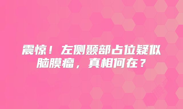震惊！左侧颞部占位疑似脑膜瘤，真相何在？