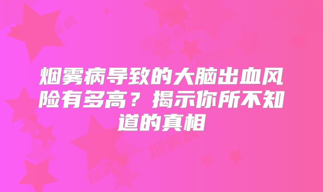 烟雾病导致的大脑出血风险有多高？揭示你所不知道的真相