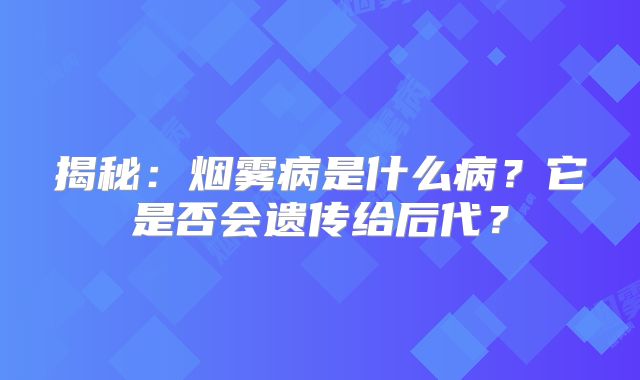 揭秘：烟雾病是什么病？它是否会遗传给后代？